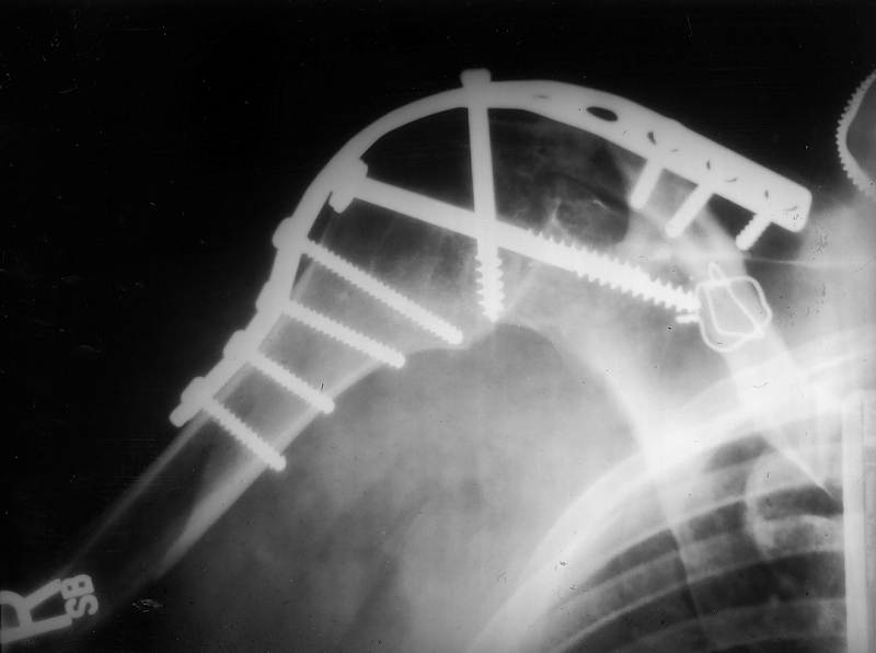 Surgical Treatments