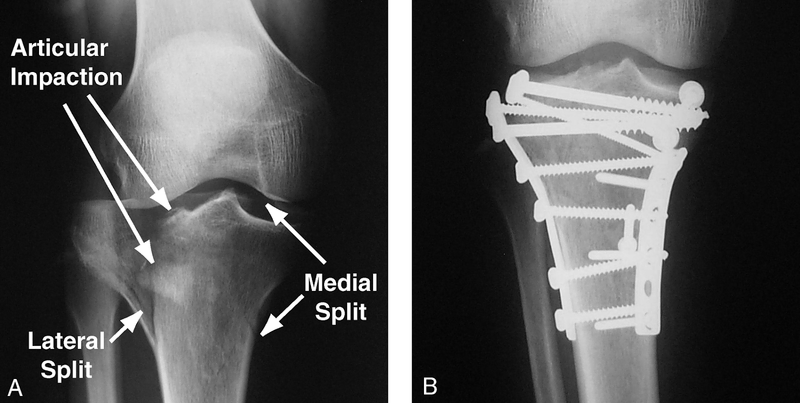 Surgical Treatments