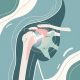 Rotator Cuff Tears: Diagnosis and Arthroscopic Repair