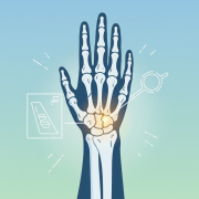 scaphoid-fracture-diagnosis,-management,-and-the-importance-of-prompt-treatment Scaphoid Fracture: Diagnosis, Management, and the Importance of Prompt Treatment