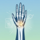 Scaphoid Fracture: Diagnosis, Management, and the Importance of Prompt Treatment