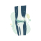 Surgical Management and Post-Operative Rehabilitation of Radial Head Fractures