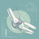 Total Elbow Arthroplasty: A Comprehensive Review